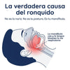 Dispositivo Bucal Antirronquidos ResLab