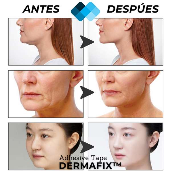 LiftInvisible Parche Facial Natural